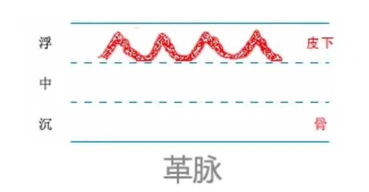 中医28脉诊歌诀及示意图,中医28脉全部脉象图解