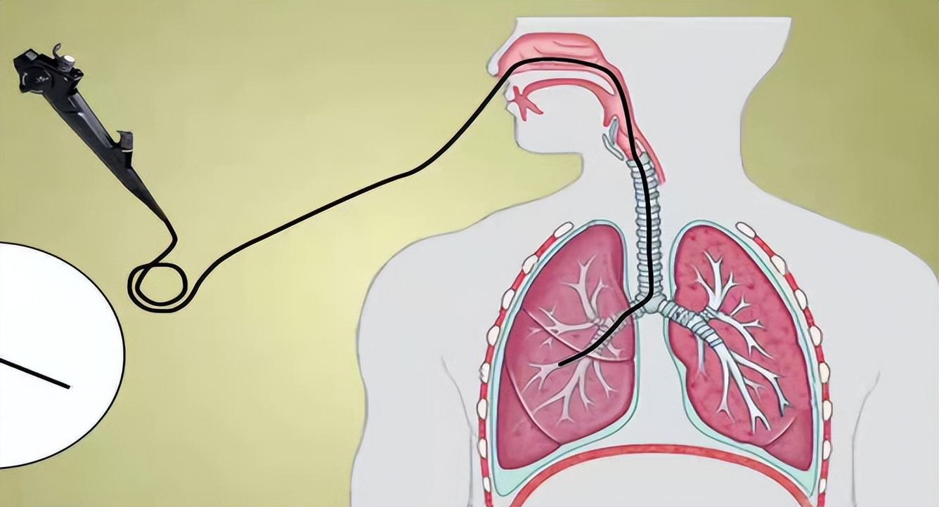 小孩咳嗽发烧前面高热后面低热,孩子反复高热咳嗽是什么原因