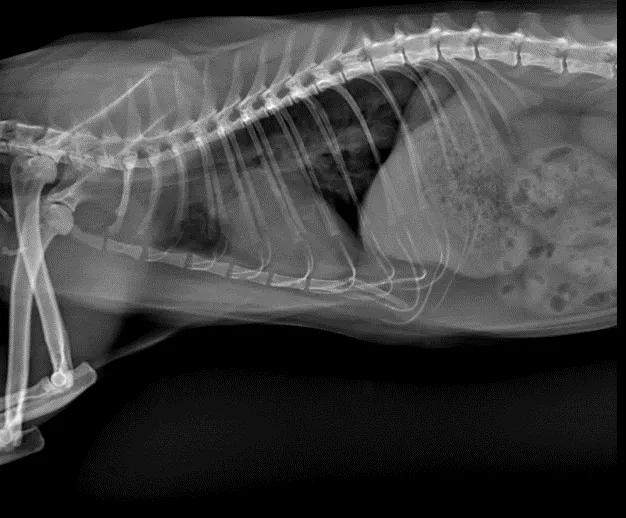 二尖瓣发育不良病例总结