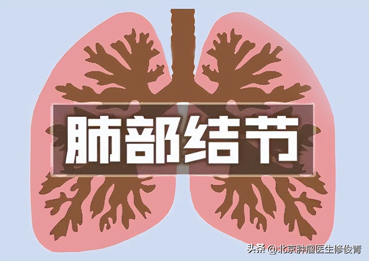 治肺结节软坚散结的药材有哪几种,消除肺结节用软坚散结的是什么药