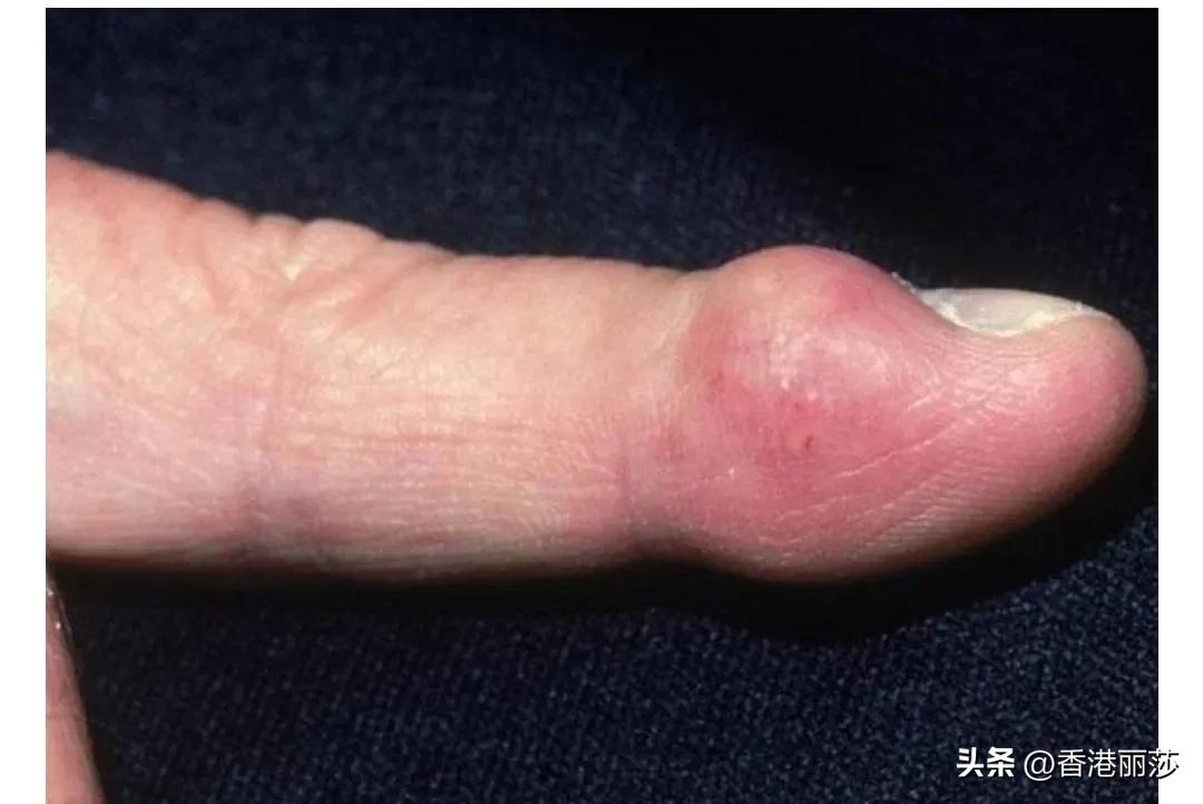 57岁大姐香港洗碗工月入过万，身体不适不敢请假，心里酸楚话谁知