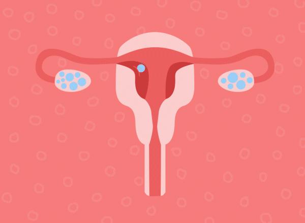 单角子宫囊胚移植几天后着床,移植未着床为什么感觉子宫发紧