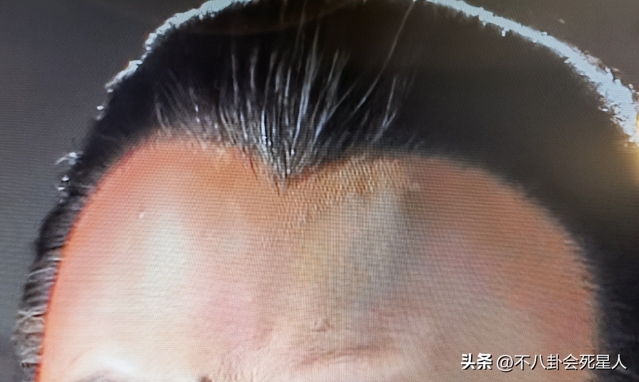 演员假发套穿帮,假发穿帮镜头