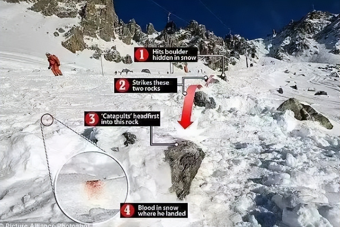 车王舒马赫事故,车王舒马赫健康状况