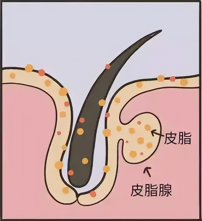 身上老是洗不干净是怎么回事,洗完澡皮肤干痒起白皮屑怎么回事