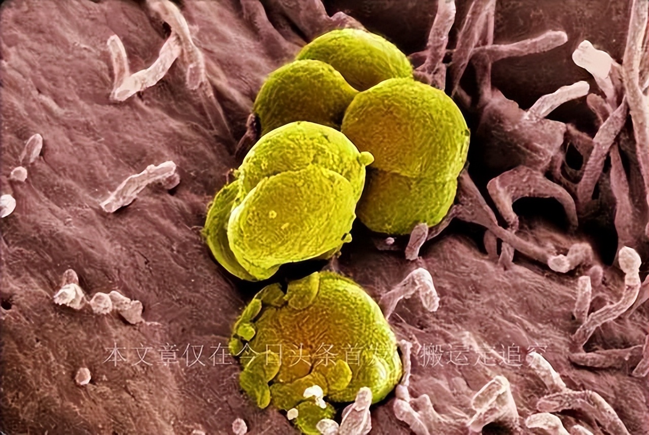 南宁小伙用酒店毛巾患上淋病,南宁男子患淋病