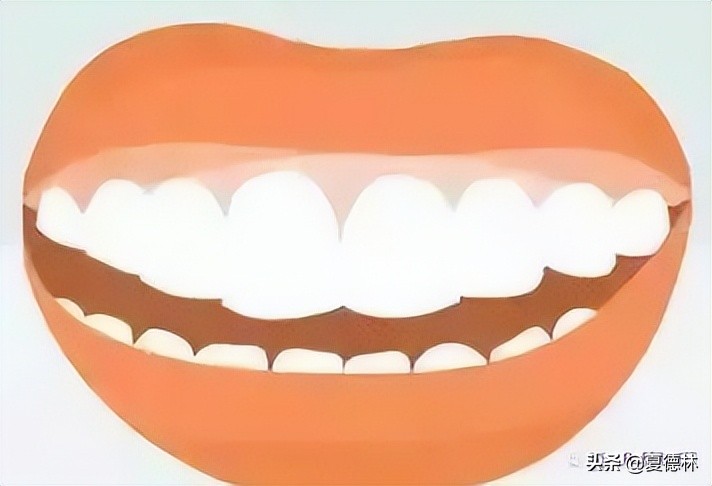 笑起来露牙龈的很难看怎么改善,笑起来不好看露牙龈怎么办