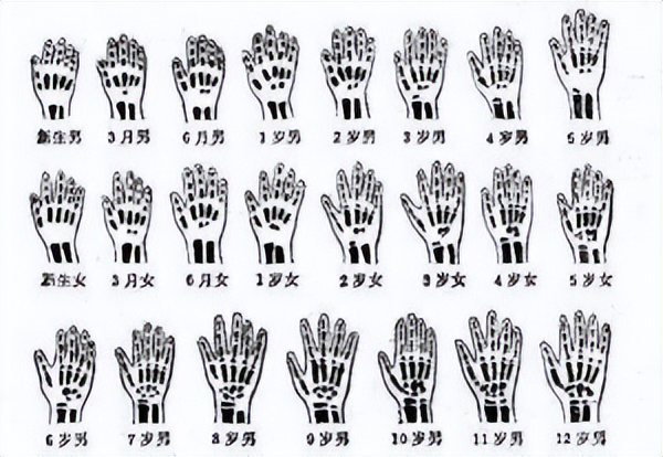 怎么知道自己的骨龄多大,如何看骨龄有多大