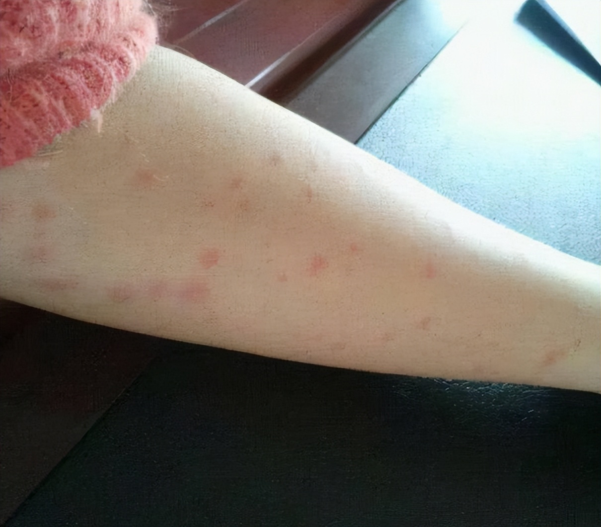 艾滋病后悔药价格,艾滋病后悔