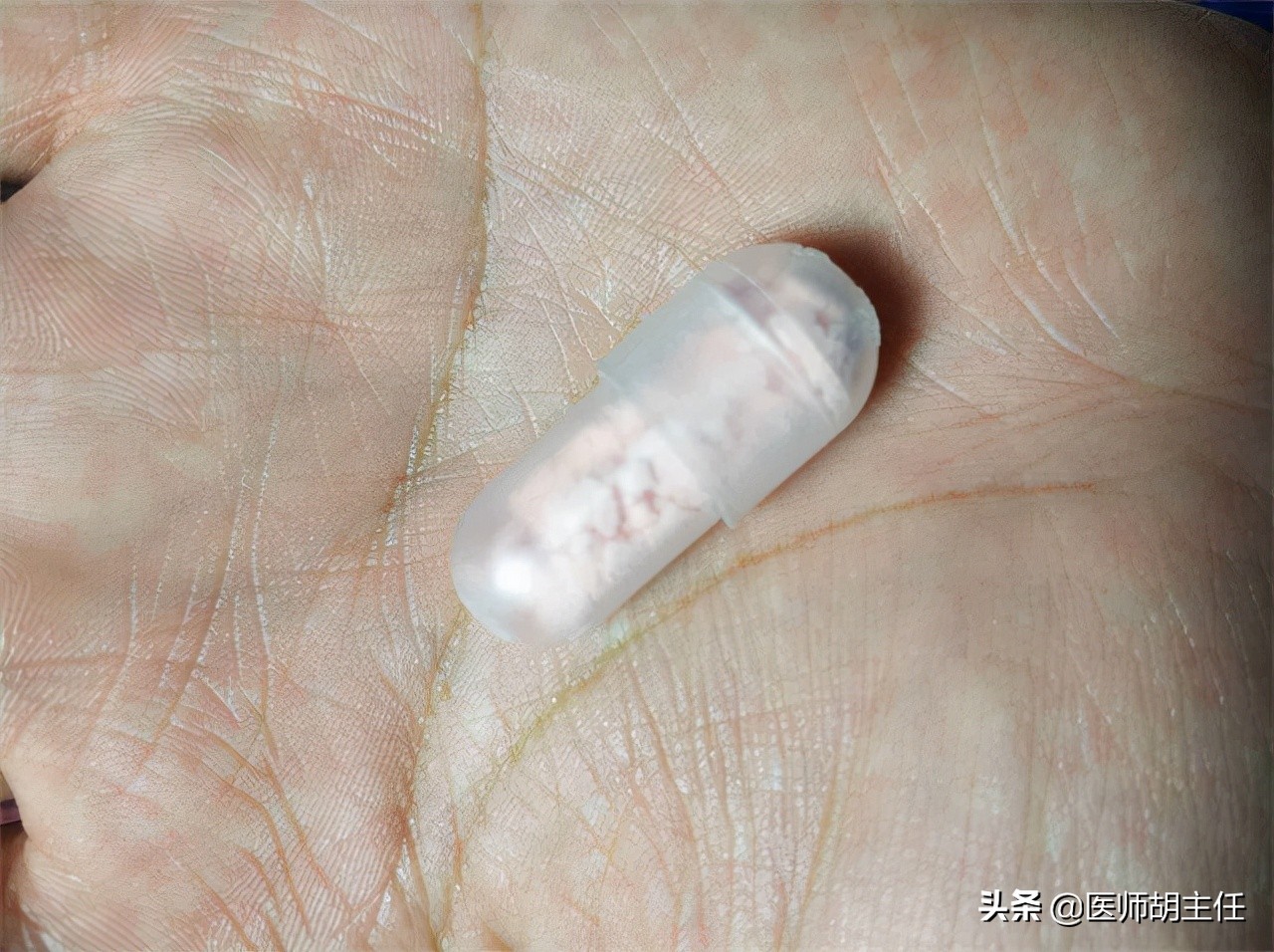 得了口腔溃疡怎么缓解疼痛更有效,口腔溃疡太疼了有啥偏方