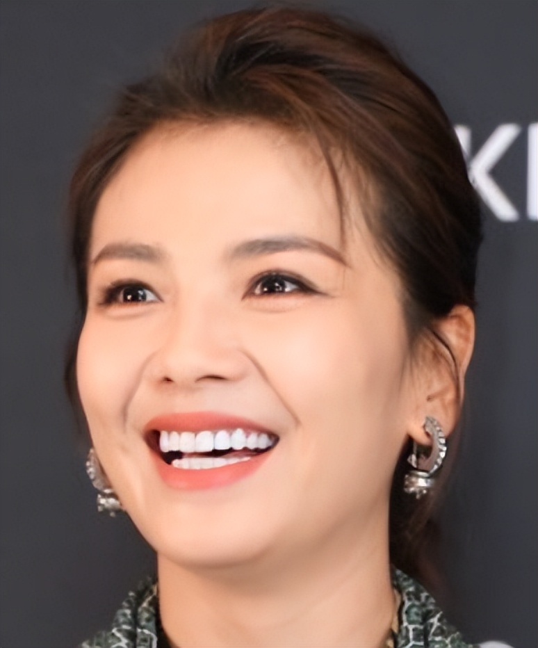 脸部造假，发量造假，牙齿造假，女明星除了性别，还有什么是真的