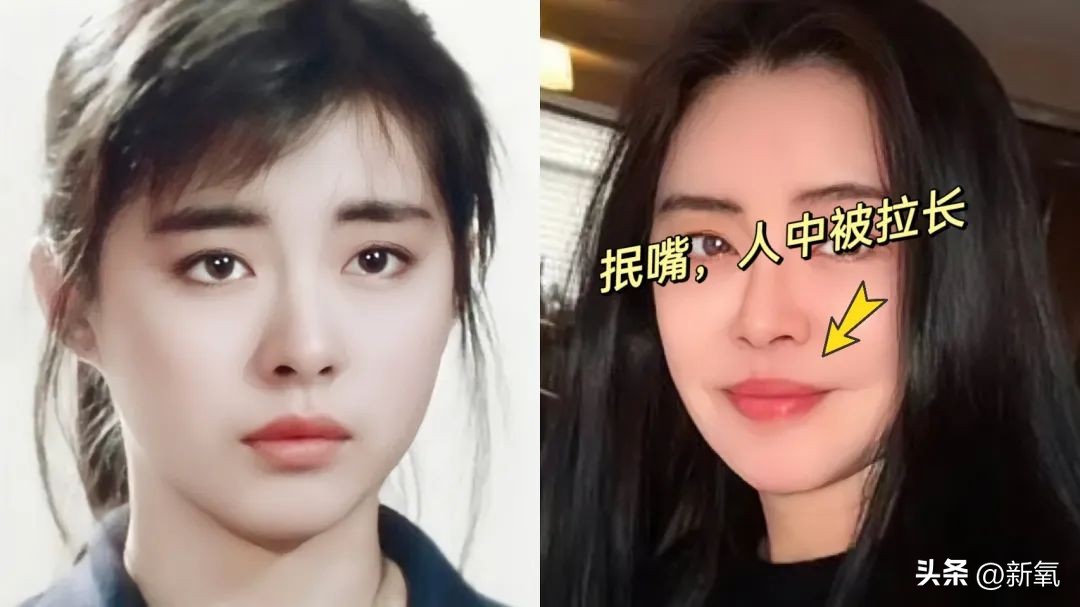 牙齿正畸和骨骼正畸的区别,牙齿正畸和眼轴增长有关系吗