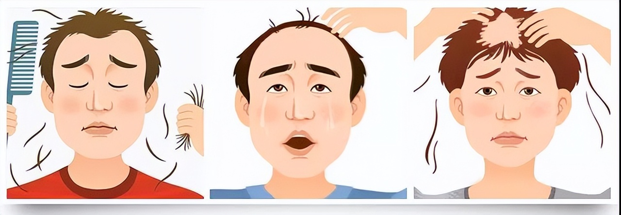 植发后又掉头发是什么原因,植发过后头发还是稀疏怎么办