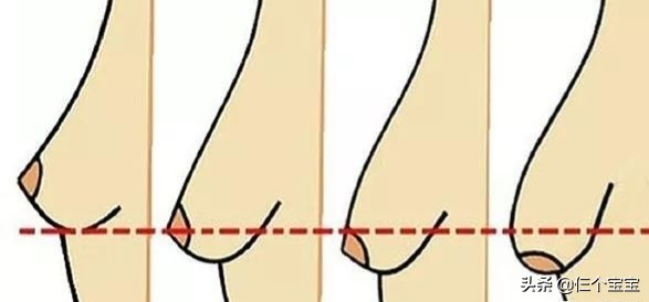 乳房下垂、产后漏尿、小肚腩，这些产后问题千万别不当回事