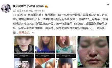 张庭涉嫌传销被查处综艺节目,张庭夫妇涉传销事件受牵连的明星