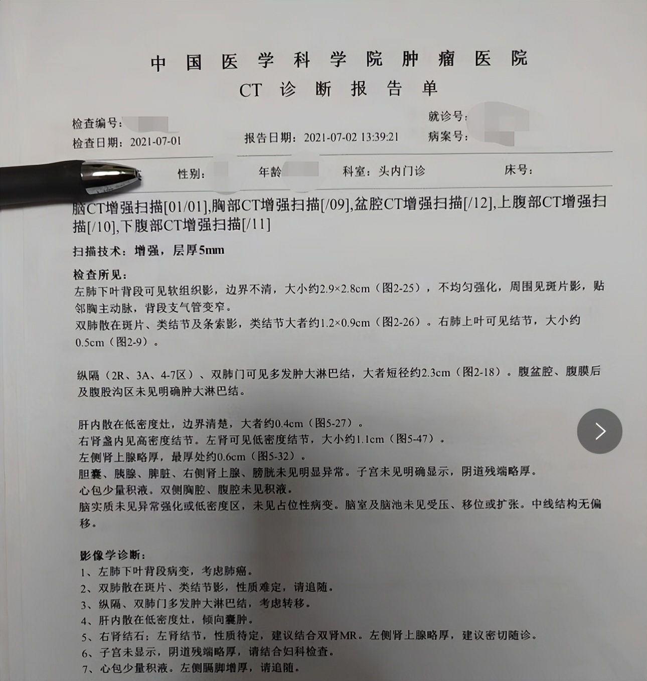 从晚期肺癌到肿瘤消失,从肺癌晚期到肿瘤消失