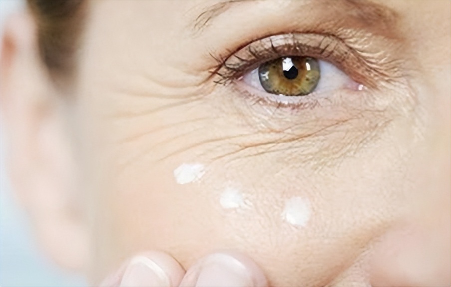 解决鱼尾纹最好的办法,教你一招如何淡化鱼尾纹