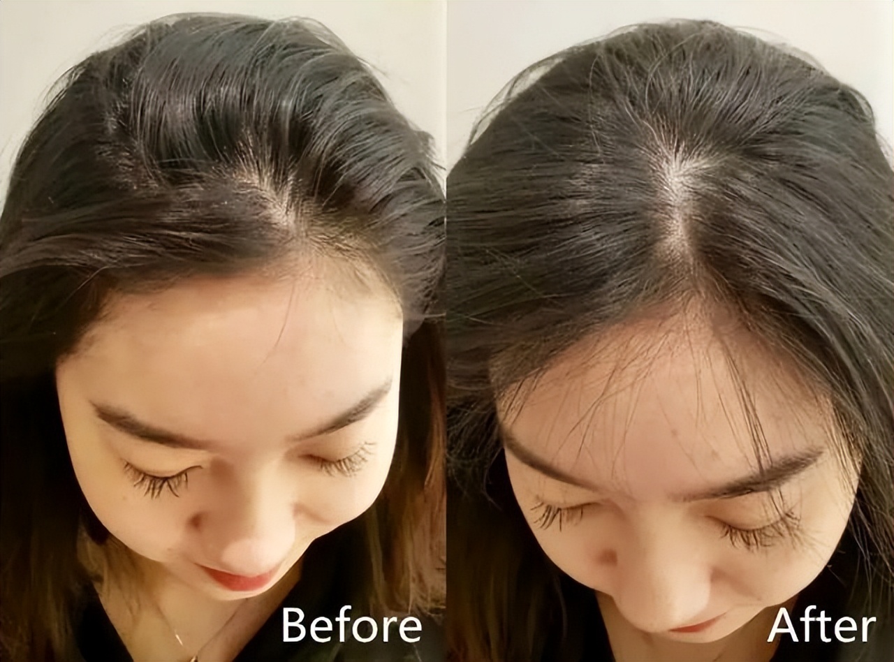 如何洗完头头发蓬蓬松松,洗完头头发干燥怎么办