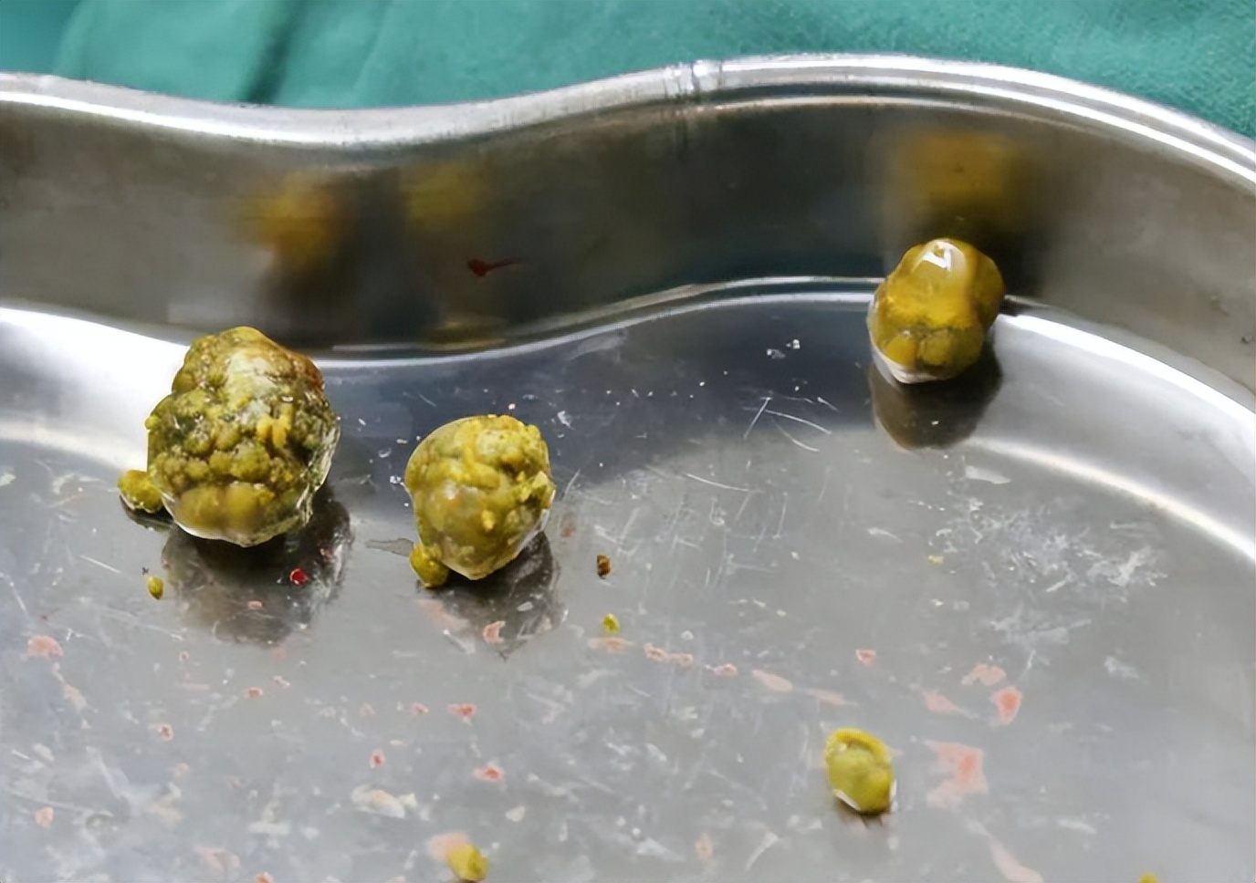 每天吃一片维生素c坏处,每天吃一片维生素c会怎样