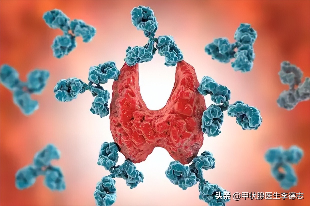 甲状腺大病理是什么,甲状腺大讲堂