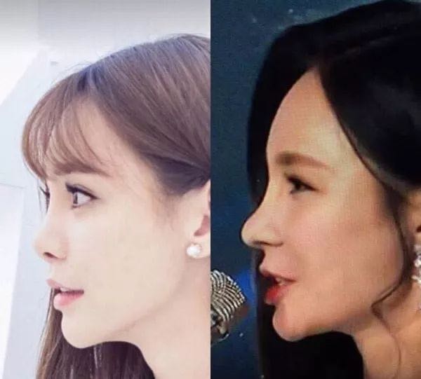 盘点整容失败惨不忍睹的30位女星,那些整容整失败的女明星