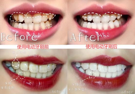 如何辨别好用的电动牙刷,电动牙刷到底好不好用