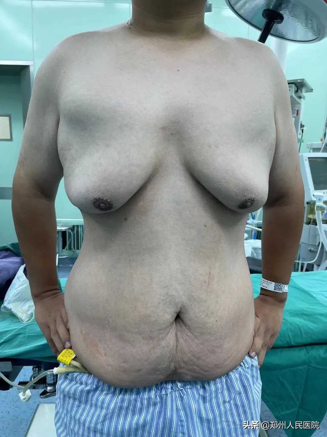 210斤肌肉男减肥成功案例,30斤胖小伙减肥成功变帅气