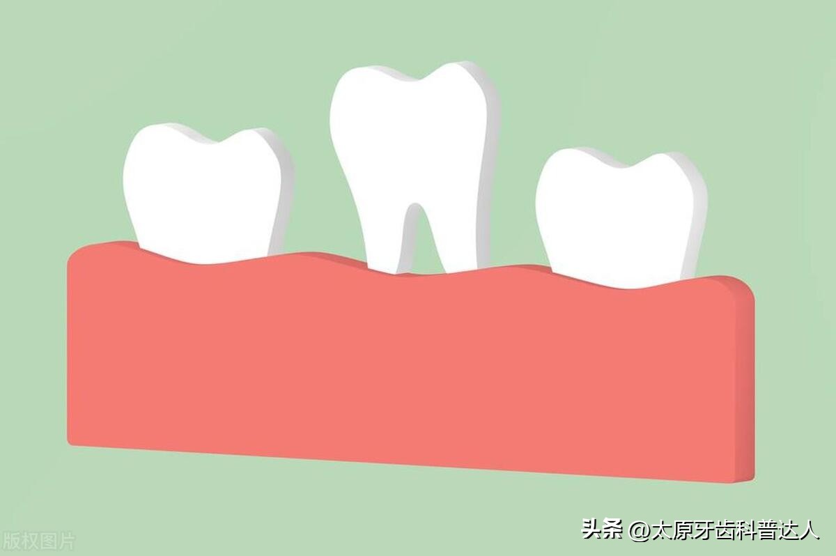 牙龈出血牙齿松动的原因是什么,牙齿松动牙缝越来越大是什么原因