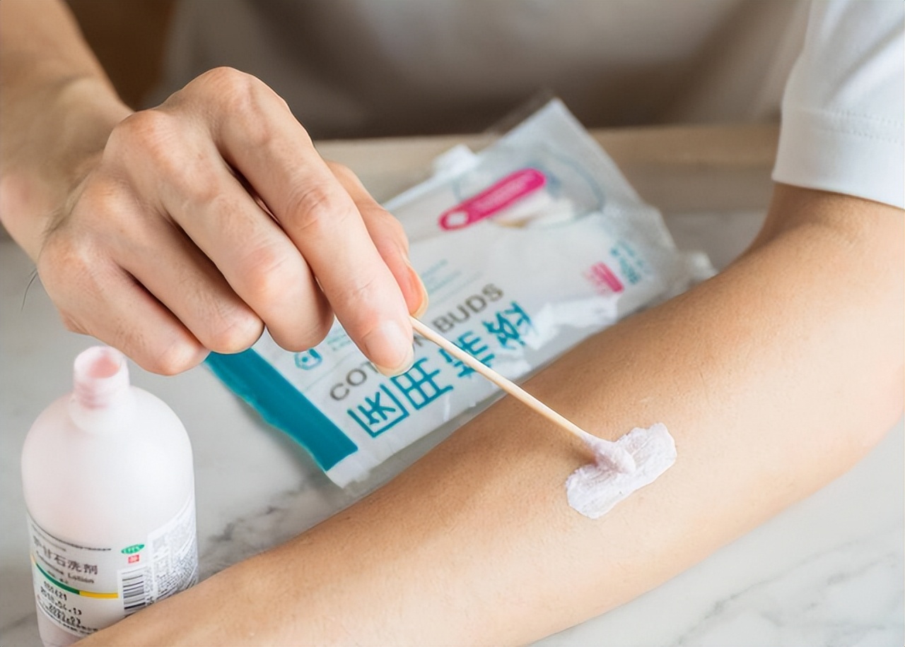 3块钱一瓶的炉甘石洗剂，连世卫组织都推荐，可以用来治哪些病？