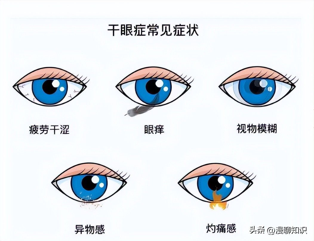 干眼病属于眼底病吗,干眼症状是怎么得来的