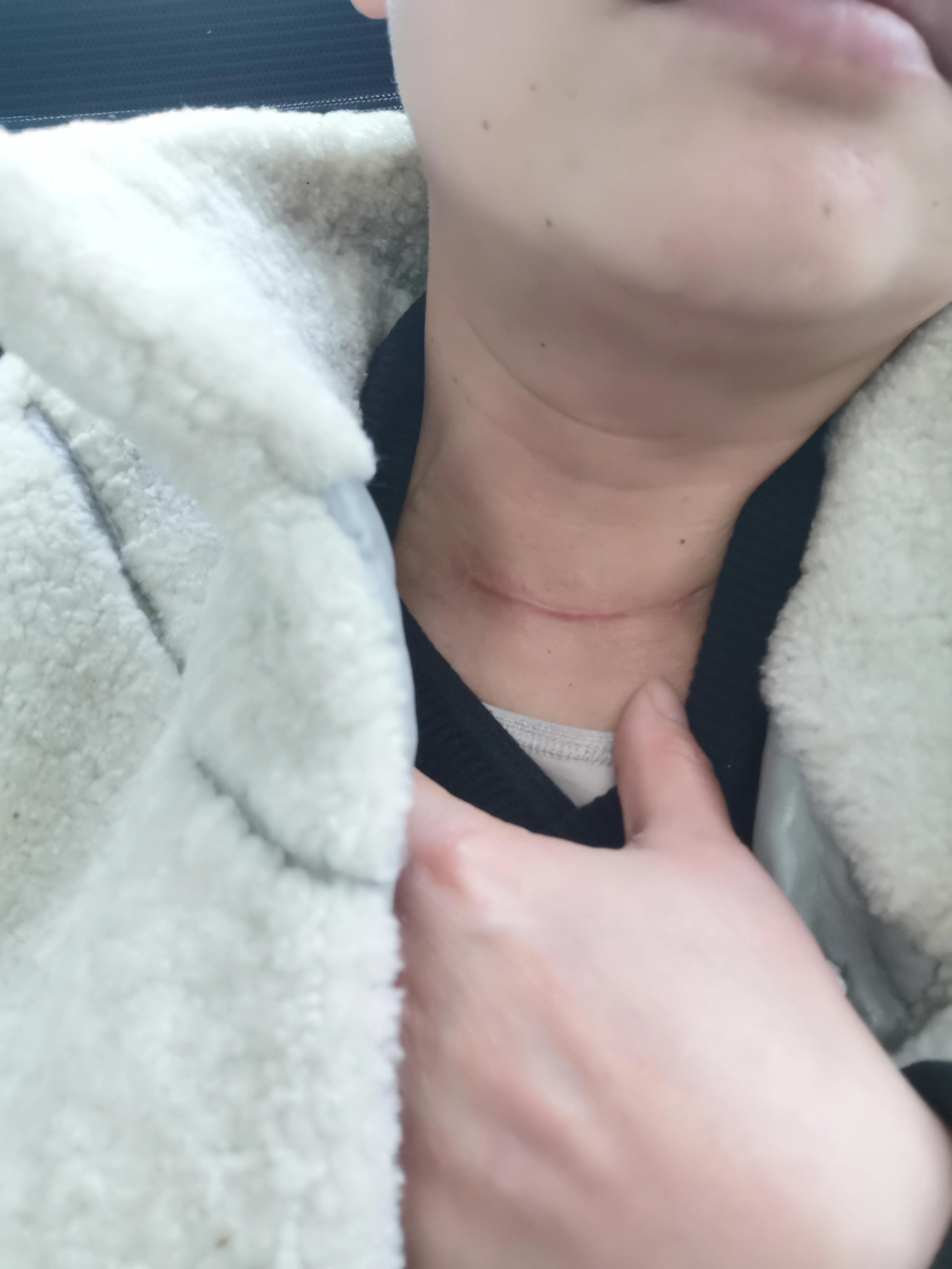 40岁做白内障手术选择什么晶体好,40岁做了白内障手术能维持多少年