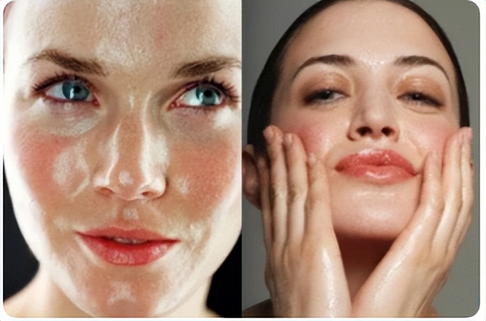 萃雪肤祛痘会不会烂脸,萃雪肤如何将脸上的毒排出来