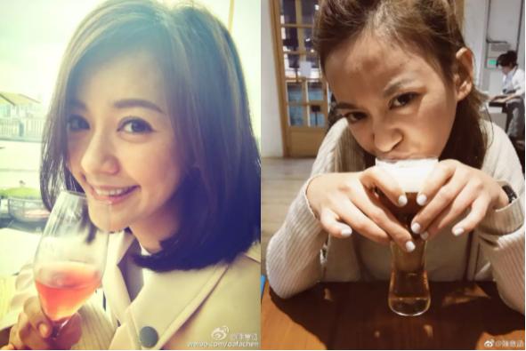 眼袋大怎么办如何解决快又好,眼袋大很显老小妙招