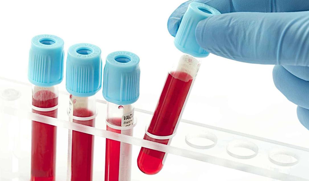 男人50岁以后雄性激素旺盛好不好,男人50岁以后激素水平高好吗