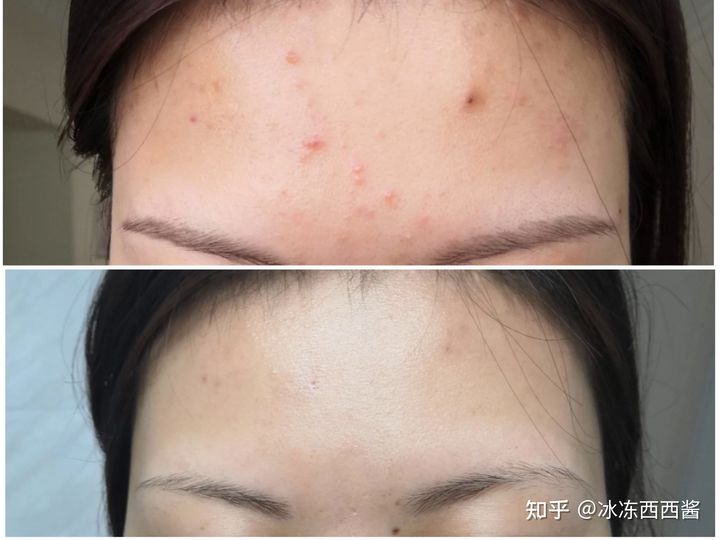 分享！吃黑芝麻皮肤会变好？常吃哪些食物会让人的皮肤越来越好？