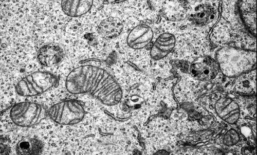 扫描电镜SEM和透射电镜TEM的区别