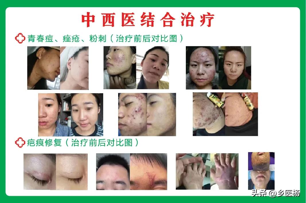 济南乡医杨涛电话,过敏性鼻炎如何调理肺脾肾功能