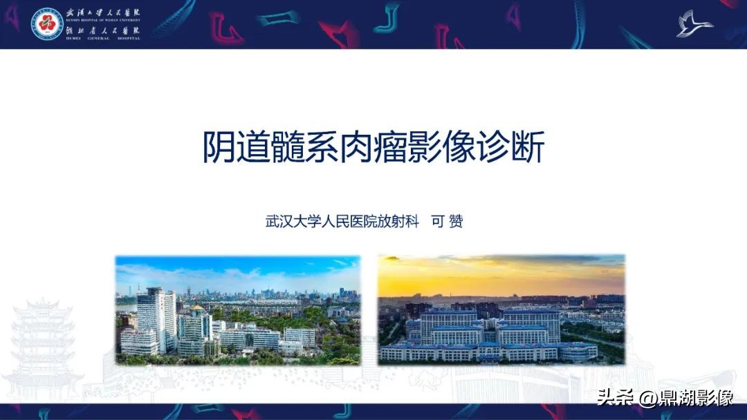 阴道里长肉瘤是啥症状,阴道肉瘤症状