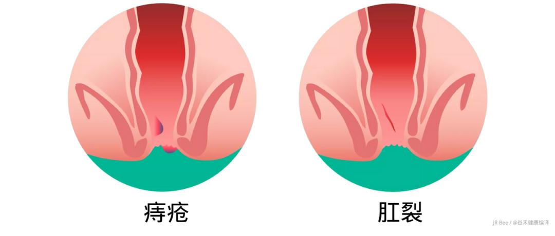 先别冲！原来你是这样的——“便便”