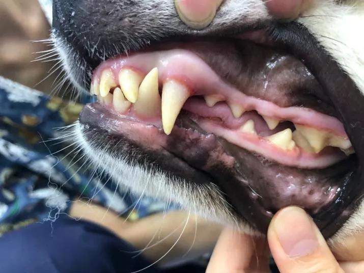 牙釉质发育不全能矫正吗,牙釉质发育不全怎么补救