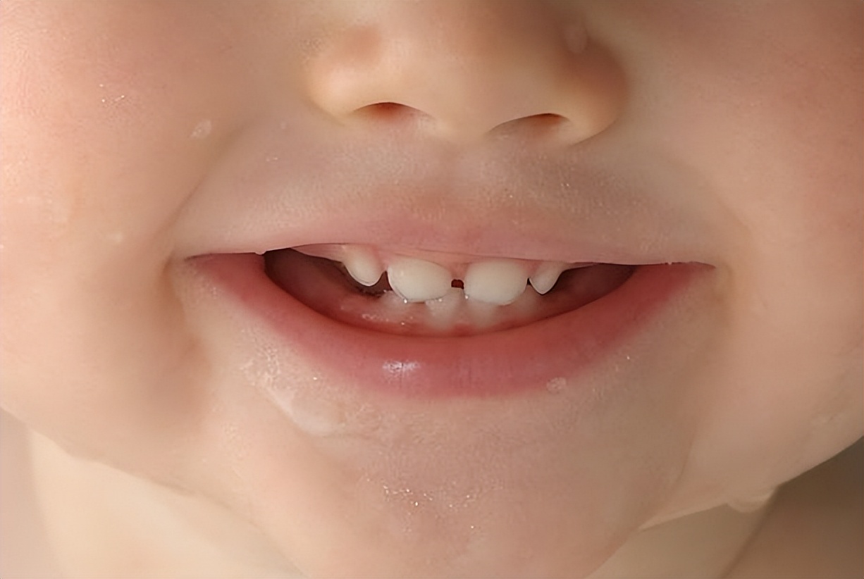 安抚奶嘴容易坏吗,安抚奶嘴什么样的好用