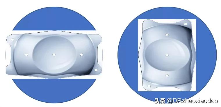 icl植入术技术问题,icd植入适应症指南