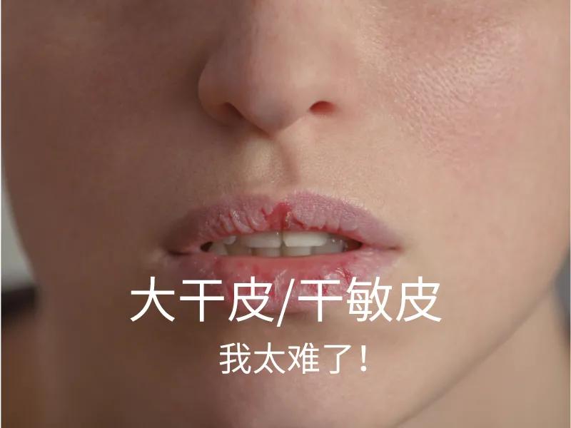 雅漾敏感肌值得买的,雅漾三重修护盈润露适合敏感肌