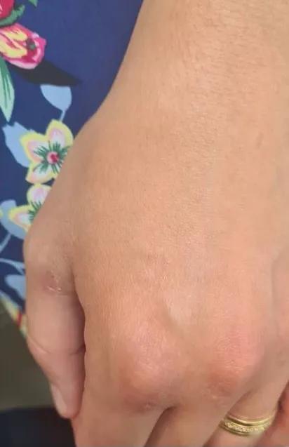 深圳清洗纹身哪家专业,推荐深圳专业洗纹身