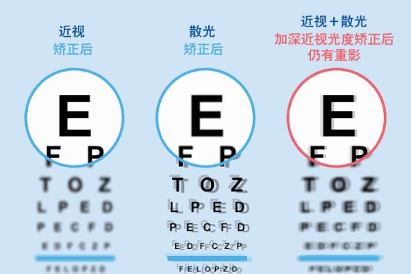 父母视力正常孩子高度散光,父母视力正常孩子失明