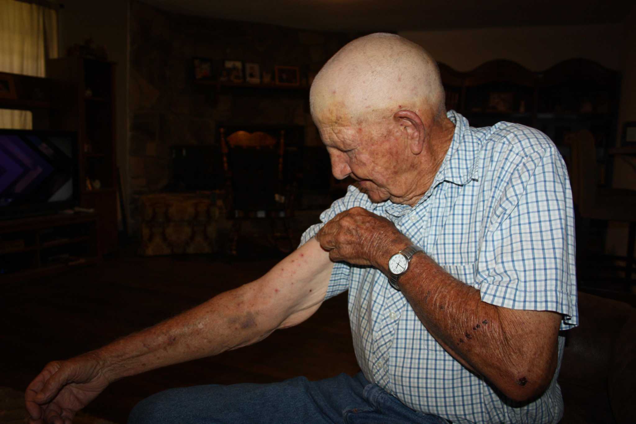 被10000只蜜蜂蛰会怎么样,如果蜜蜂蜇我们蜜蜂会死吗