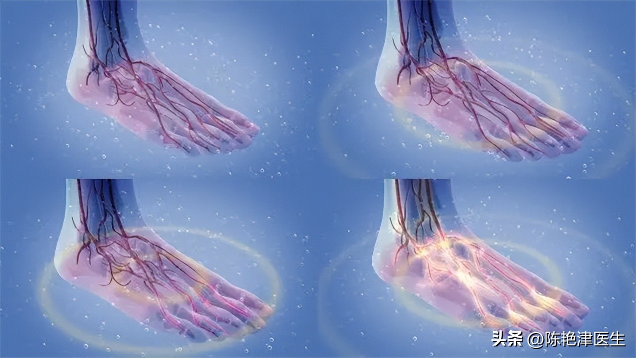 老年人腿没有力吃什么补,老年人腿无力需要补充什么营养