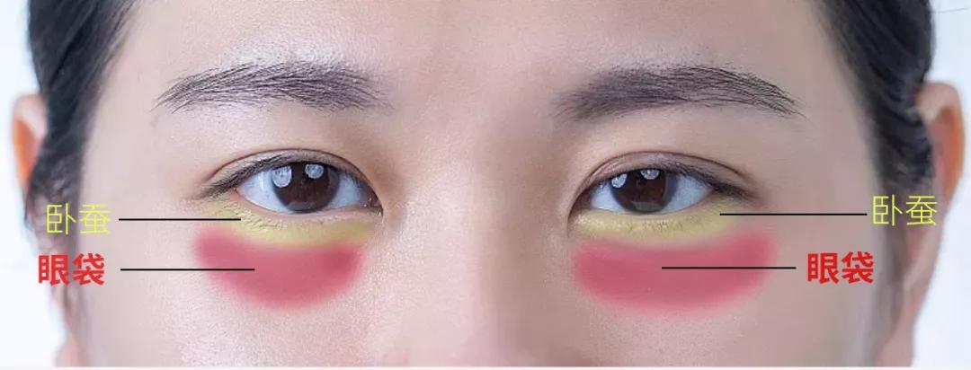 眼袋浮肿的最快治疗方法,眼袋和眼睑浮肿的区别