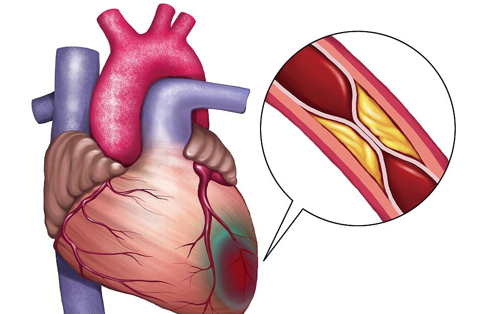 体检一般检查哪些项目中老年女性,中老年人体检要做哪几项检查