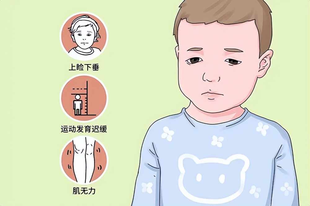 神经重症肌无力哪里可以治,重症肌无力重复神经电刺激表现